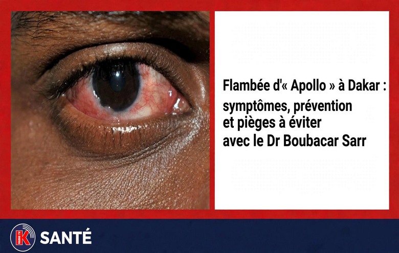 Dakar : flambée d’Apollo, les conseils du Dr Boubacar Sarr